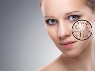Beauty tips for dry skin Beauty tips for dry skin