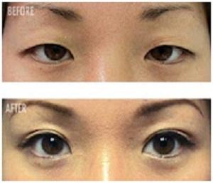 foundation for asian eyes