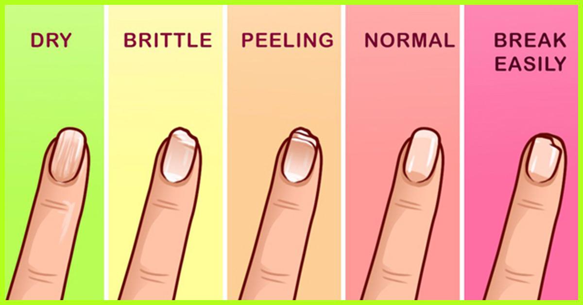 How To Make Your Nails Grow Longer