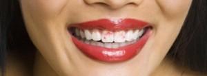 tips to avoid Lipstick on teeth
