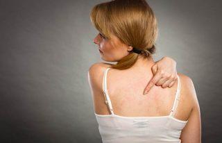 Types Of Eczema Eczema Treatment - What Are The Types Of Eczema