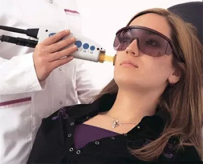 laser treatment for face