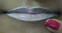 exfoliate lips