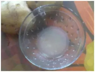 Homemade Remedies For Pimples 08 Homemade Remedies For Pimples 08