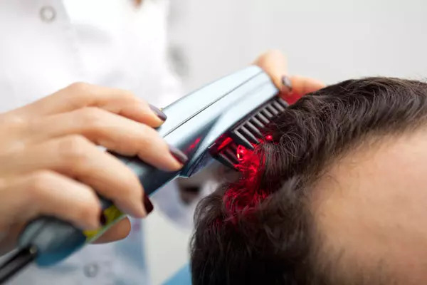 Laser Hair Therapy