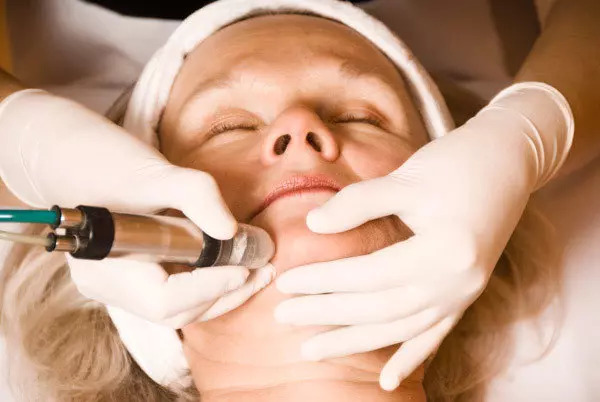electrolysis for facial hair