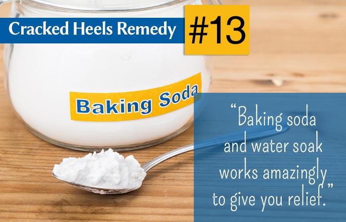 20 Simple Home Remedies For Cracked Heels