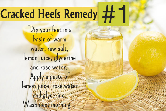 Home Remedies For Deep Cracked Feet