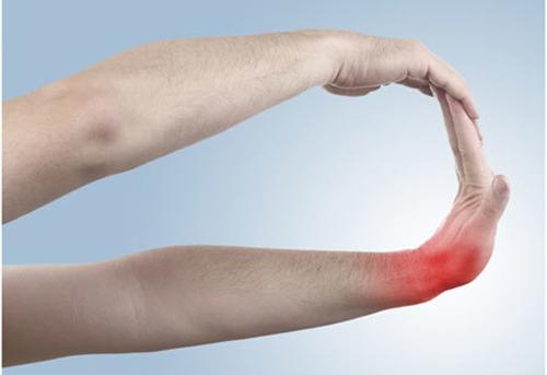 Tennis Elbow Exercises - Wrist Flex