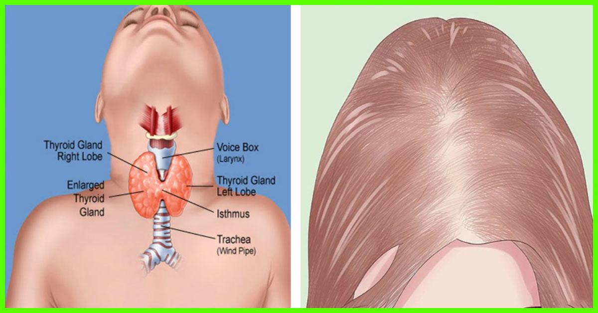 What Hormone Makes Facial Hair Grow