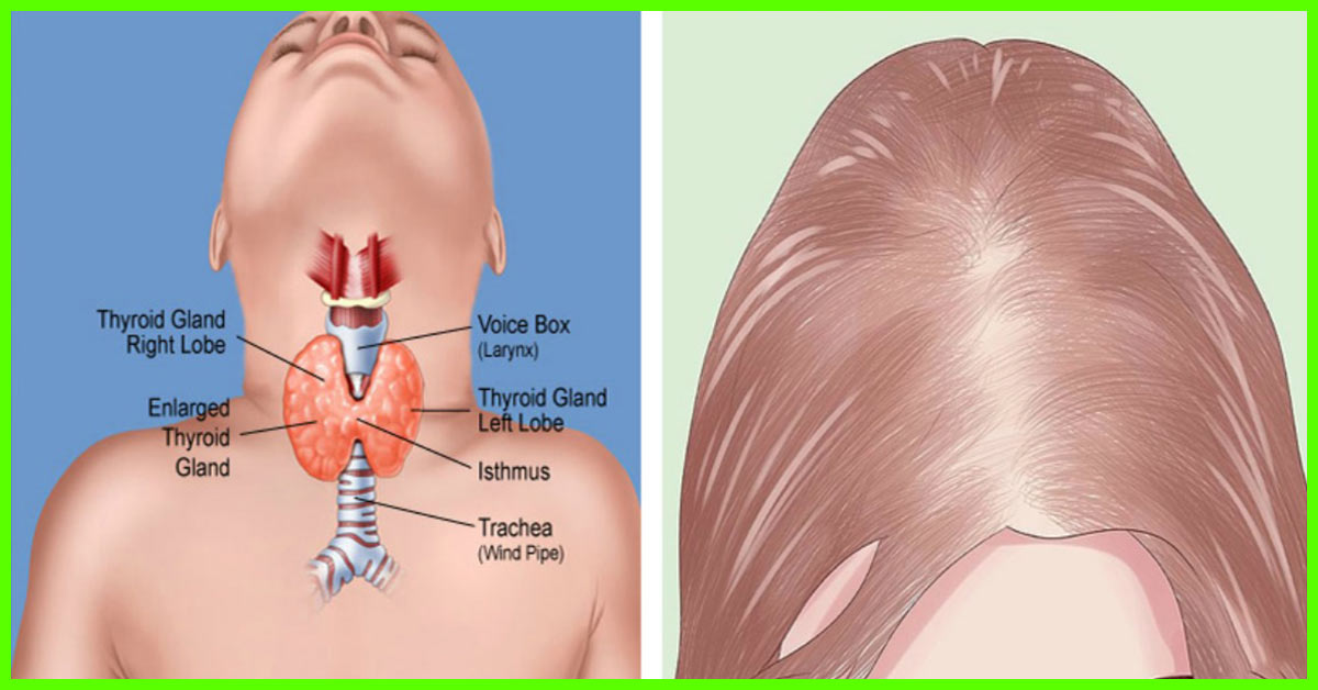 Which Hormones Are Responsible For Boosting Hair Growth And Preventing 