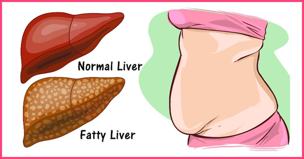 20-best-foods-to-eat-for-a-healthy-liver