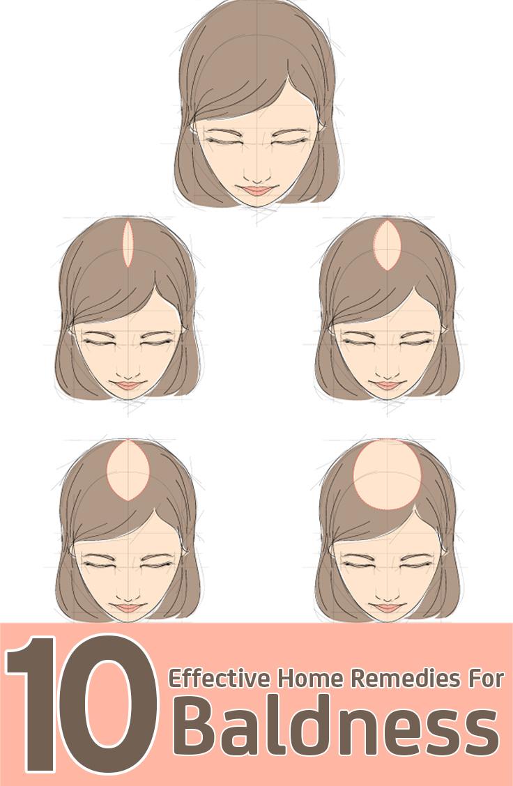 Home Remedies Baldness