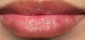 What does it mean when you have a dry patch on your lip?