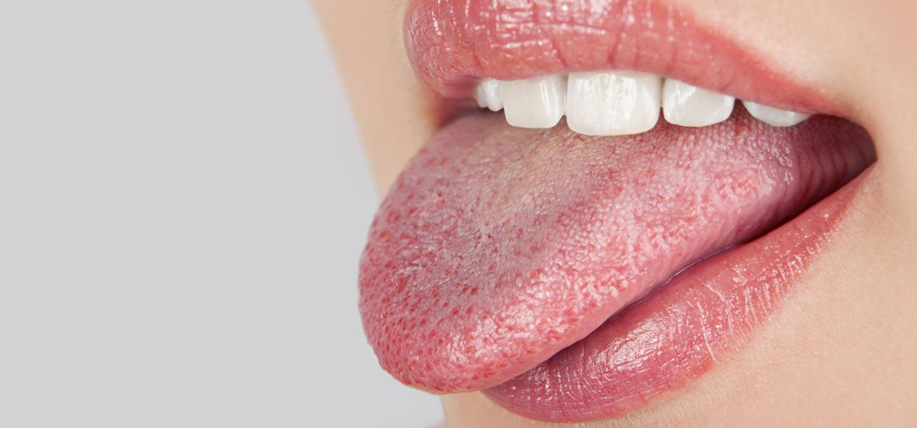 dry-mouth-symptoms-of-dry-mouth