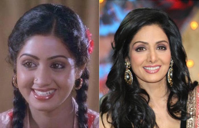 Image result for sridevi cosmetic surgery