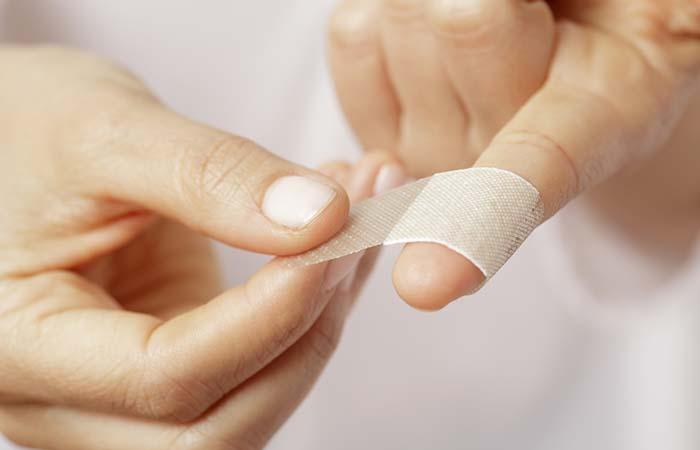 3. Wounds Are Forever