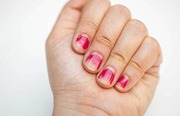 5. Untidy Cuticles