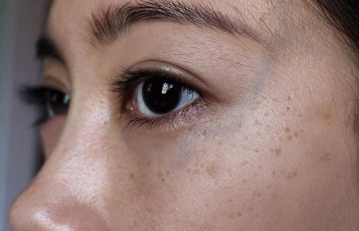 Spots