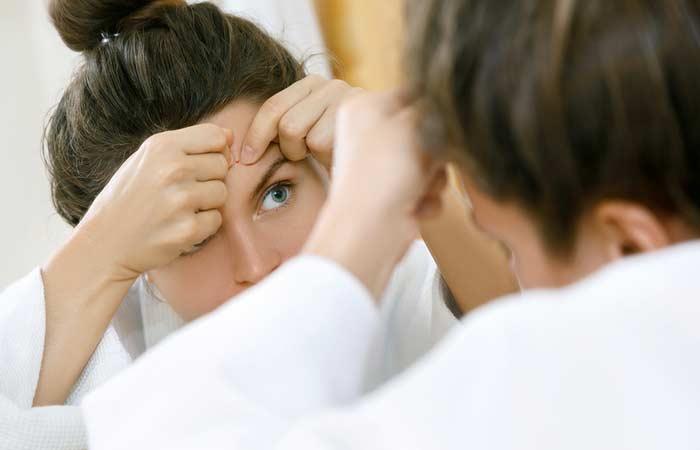 Relieve acne