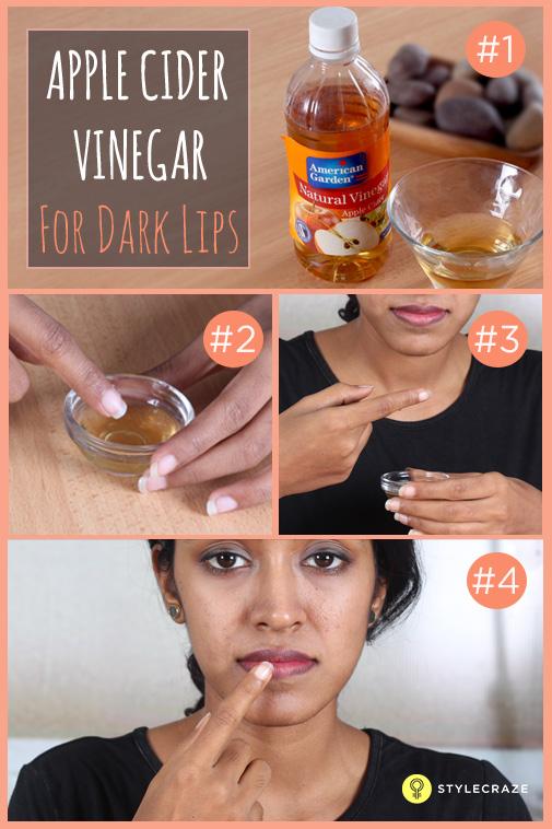 10 Proven Ways To Get Rid Of Dark Lips Naturally Worked For 99