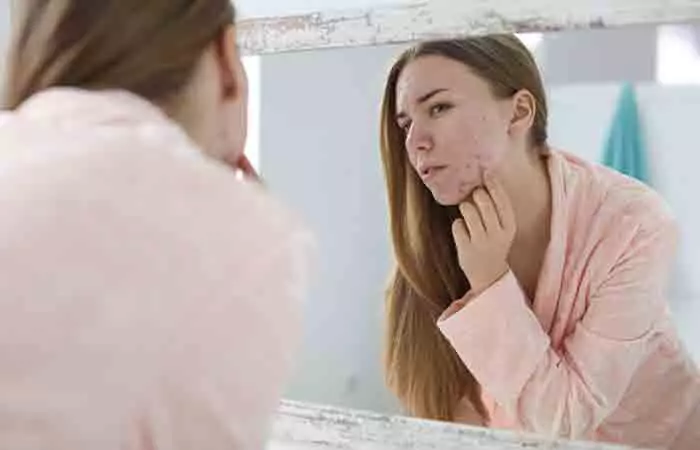 Woman worried about her acne as she looks into the mirror