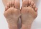 Dead Skin Under Feet: Causes, Symptom...