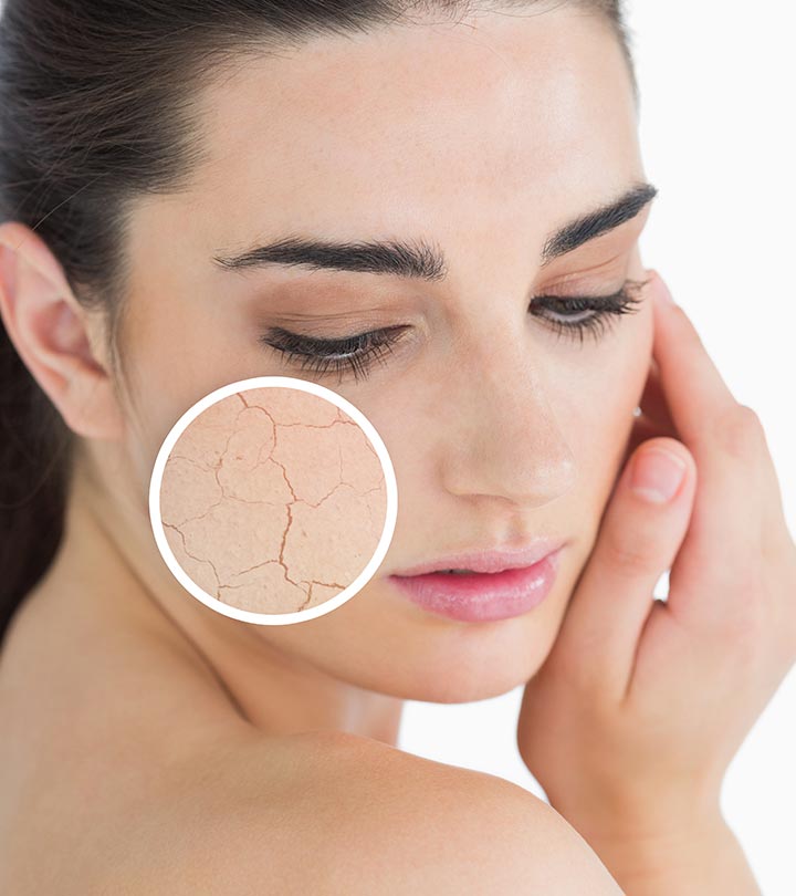 10 Top-Tipps für trockene Haut