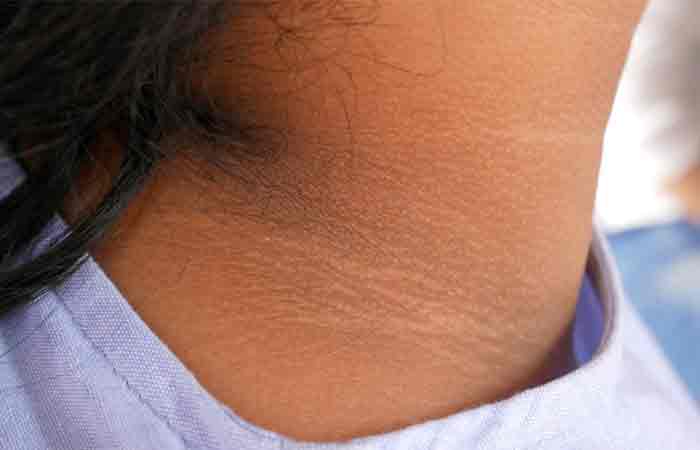 Close up of dark skin in the neck area