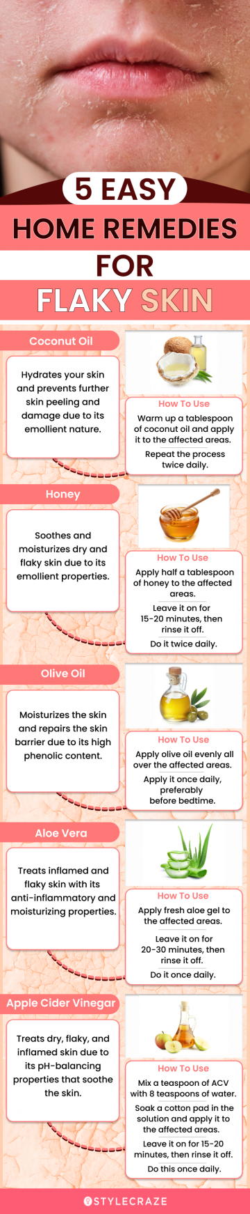 5 home remedies for flaky skin (infographic)