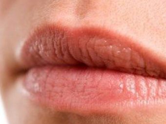 Bleeding-Lips-–-How-To-Reduce-The-Fine-Lines