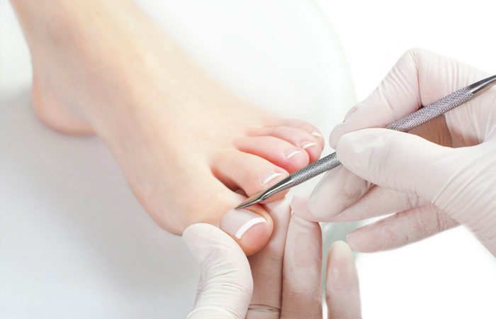 Make your feet soft with a cleaning needle