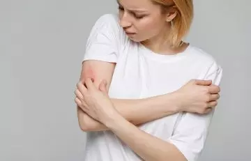Woman experiencing a type of skin infection