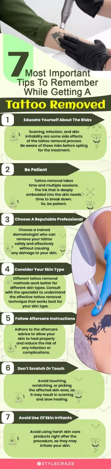 7 most important tips to remember getting your tattoos removed (infographic)