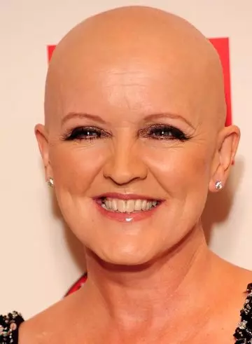 Ultimate bald hairstyle by Bernie Nolan as bold bald