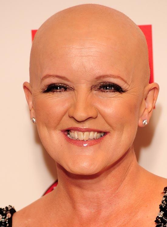 19 Women With Shaved Heads  Female Celebs With Buzzcuts