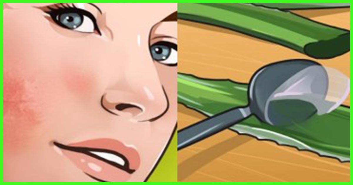 12 Aloe Vera Face Packs For Different Skin Types 12 aloe vera face packs for different