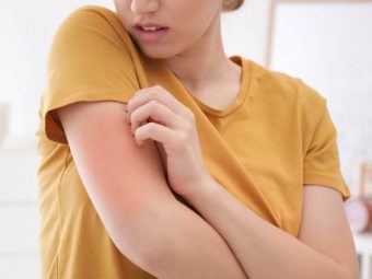 Managing, Treating, And Coping With Eczema Everything You Need To Know