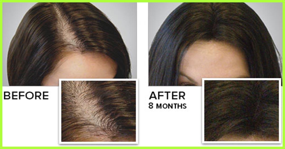 How Can I Grow My Hair Faster 5 Essential Vitamins 2 Minerals And Other Nutrients That May Improve Hair Growth