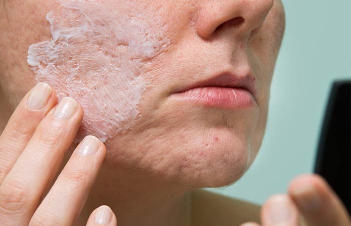 10 Best Home Remedies To Get Rid Of Facial Scars Naturally
