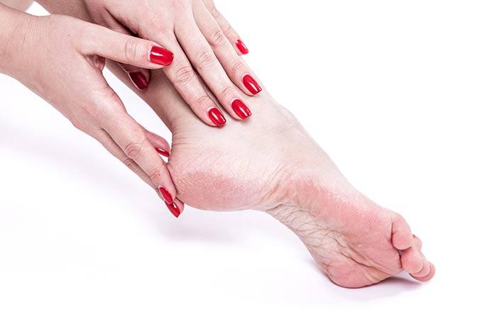 Turmeric Benefits - Heals Cracked Feet
