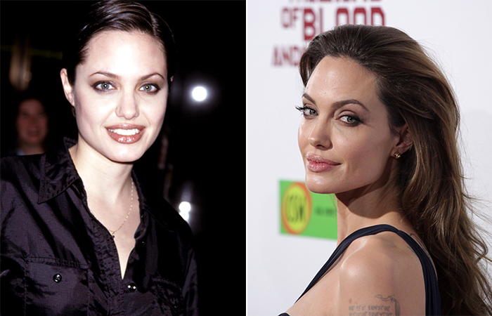 Angelina Jolie before and after nose job