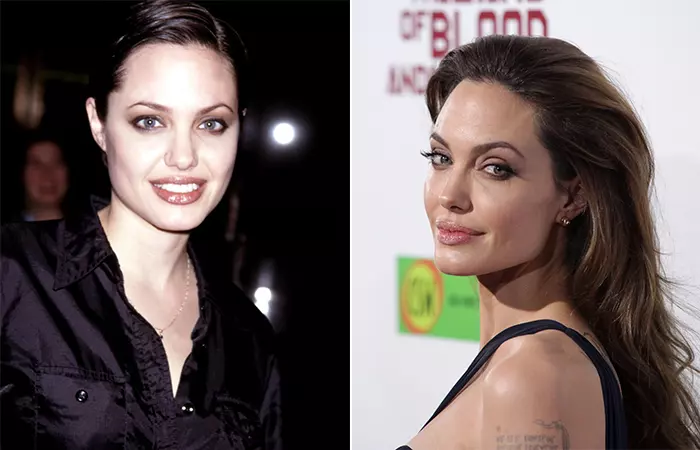 Angelina Jolie before and after nose job