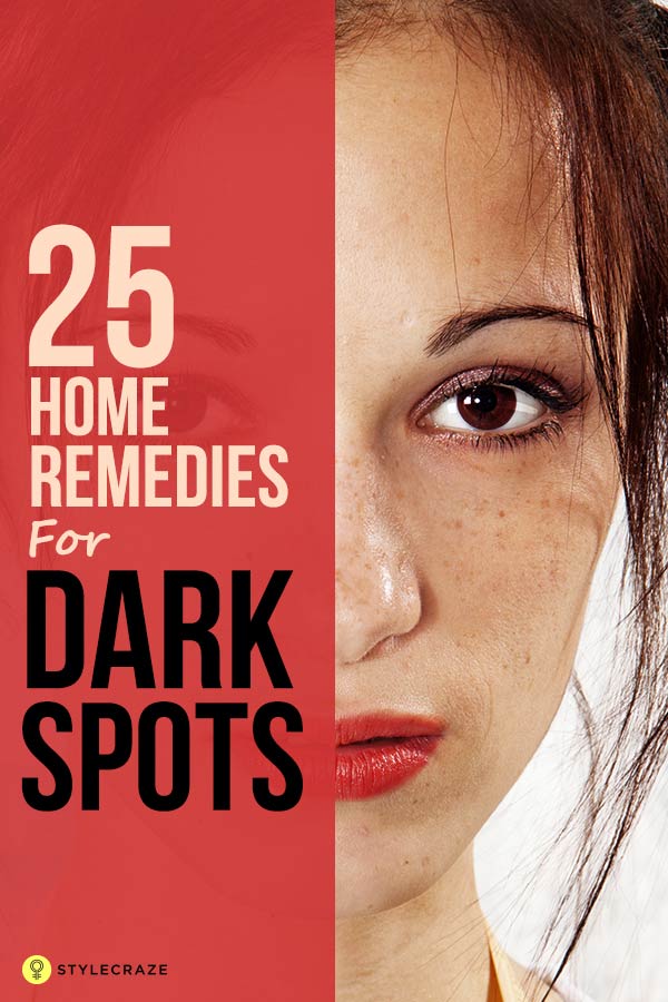 6 Home Remedies To Remove Dark Spots On The Face