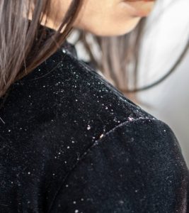 How To Get Rid Of Dandruff Naturally - 18...