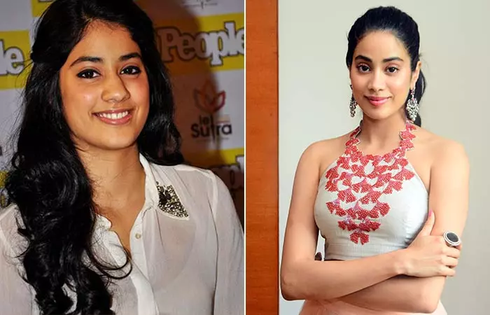 Jhanvi Kapoor before and after nose job