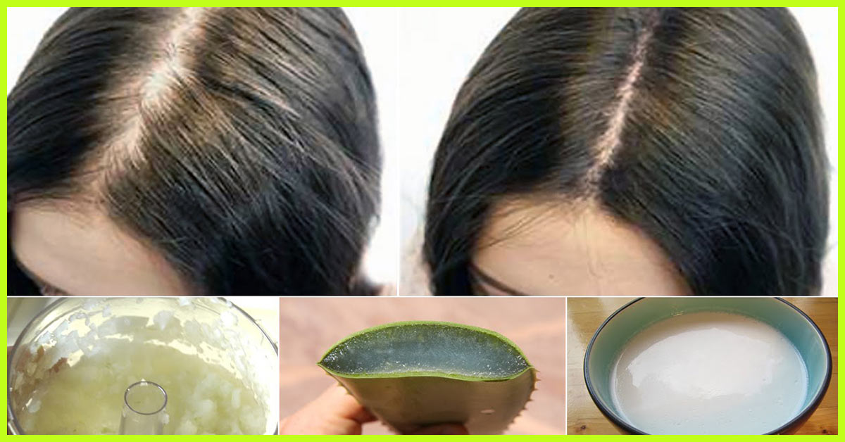 Diet Chart For Hair Regrowth