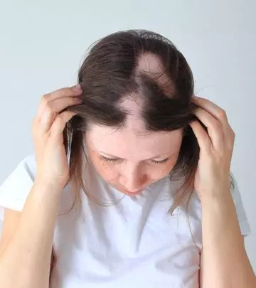 Alopecia Areata Causes, Types, And Treatment