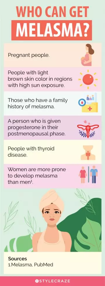 who can get melasma (infographic)