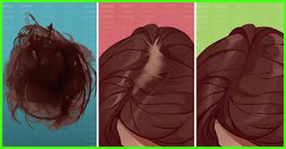 6 Types Of Hair Fall Causes, How To Diagnose, & Treatments